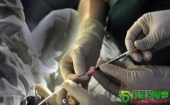 ʵ���Թ�Ӥ��ȡ�ѳ龫ȫ����(ͼ)